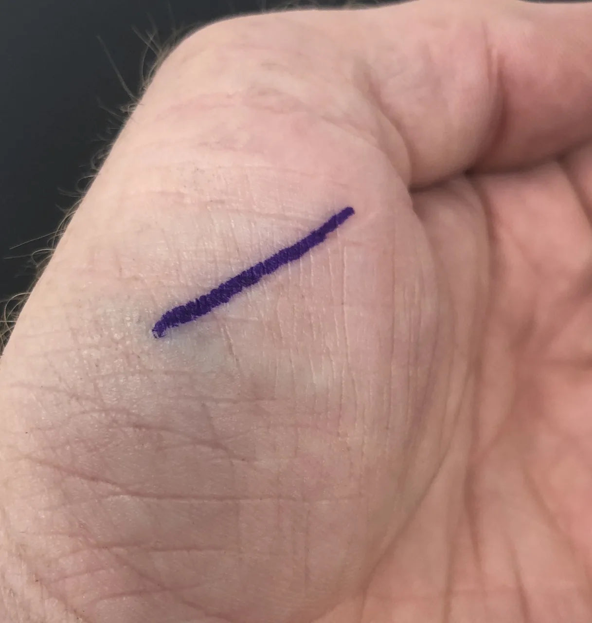 a line on a hand from a stencil marker 